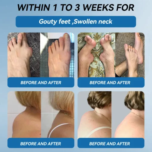 𝐋𝐢𝐩𝐌𝐚𝐩𝐬® BPC-157 Joint & Gout Relief Cream