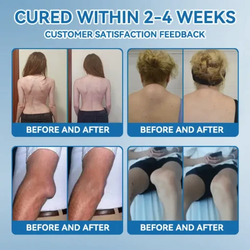 𝐋𝐢𝐩𝐌𝐚𝐩𝐬® BPC-157 Joint & Gout Relief Cream