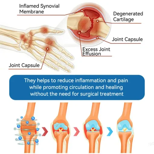 𝐋𝐢𝐩𝐌𝐚𝐩𝐬® BPC-157 Joint & Gout Relief Cream