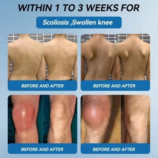 𝐋𝐢𝐩𝐌𝐚𝐩𝐬® BPC-157 Joint & Gout Relief Cream
