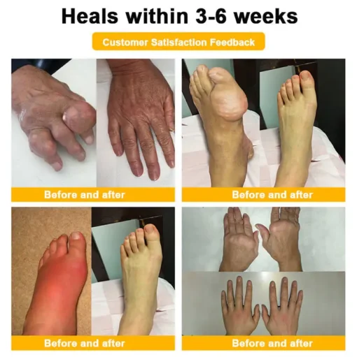 RAINDEW® BEE VENOM LITHOSPERMUM Pain-Relief Bone Healing Cream